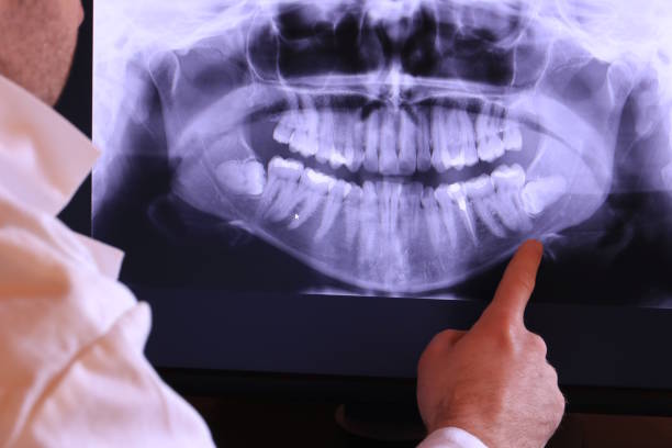 Best Emergency Tooth Extraction in Andover, KS